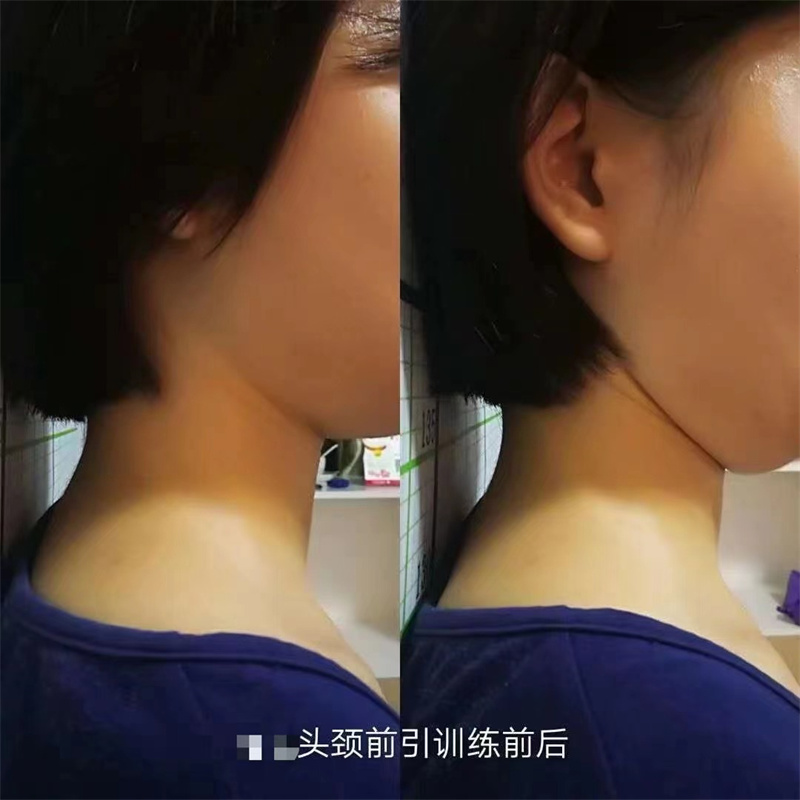 成功案例 