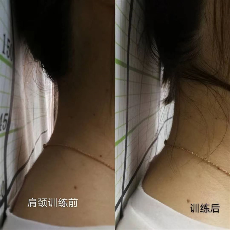 成功案例 