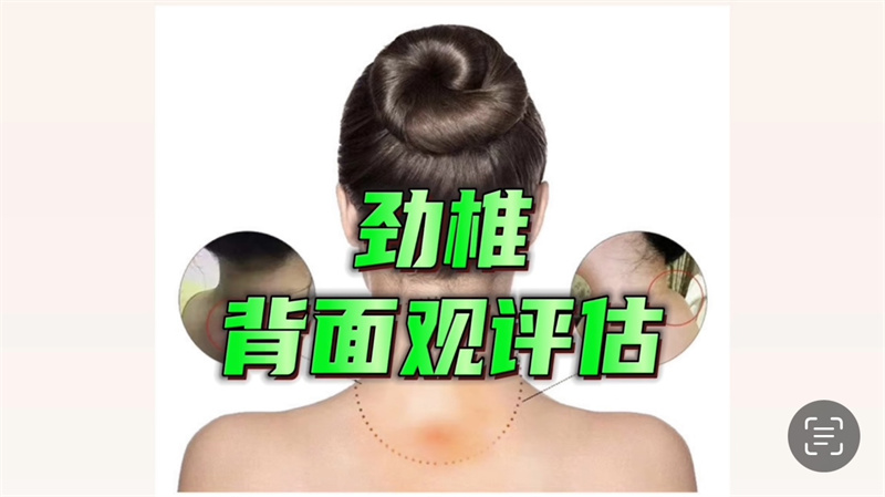 颈椎训练